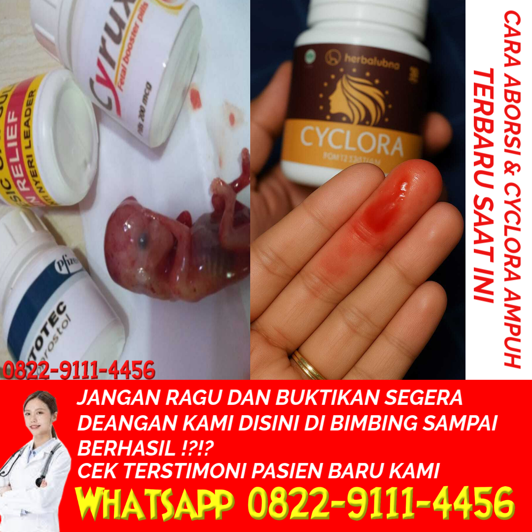 cara-menggugurkan-kandungan